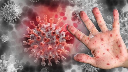 Kâbus büyüyor! Maymun Çiçeği bir ülkede daha görüldü - saglik