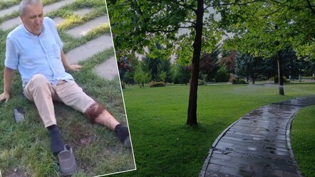 Ankara'da parka dinlenmeye giden adama, sahipsiz köpek saldırdı - gundem