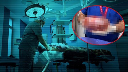 Karın ağrısı şikayetiyle gitti, karnından 3 kilo 30 santim kitle çıktı - saglik