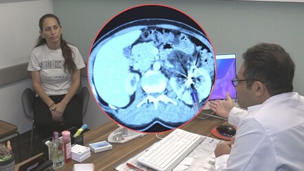 Fıtık için gitti, hayatının şokunu yaşadı! 35 yaşında tek böbrekli olduğunu öğrenen kadın son anda kurtuldu - saglik
