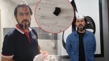 Kastamonu'da veli terörü! Delgeç ile öğretmene saldırdı, başına 5 dikiş atıldı - yasam