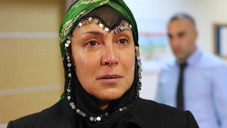 Asuman Dabak'ın yüzündeki değişim olay oldu! Açıklama yaptı - magazin