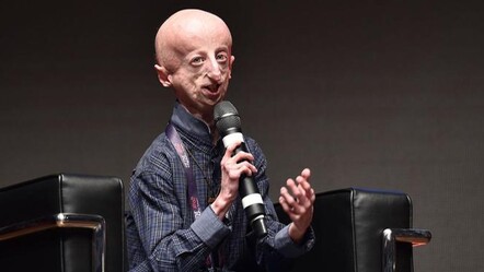 Hızlı yaşlanma hastalığı ile savaşan Sammy Basso 28 yaşında hayatını kaybetti - dunya
