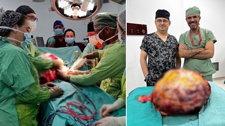Karın ağrısı şikayetiyle gitti, karnından 26 kilogramlık kitle çıkarıldı - saglik