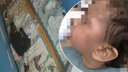 Bebeği acımadan darp etti! Öğretmenden tokat izine 'yastık izi' savunması - gundem