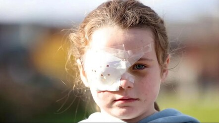 Elektronik sigara yüzünde patladı! 7 yaşındaki çocuk gözünden oldu - teknoloji