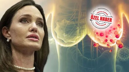 Kanserde genetik test doğru okunmalı! Angelina Jolie etkisi gereksiz ameliyatları tetikledi - saglik