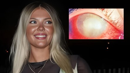 Şoke eden olay! Yüzerken çıkarmadığı lensi hayatını kabusa döndürdü - magazin