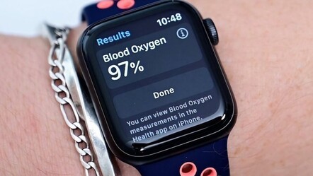 Yıllardır devam eden Apple Watch davası sonuçlandı! Tazminat ücreti görenleri güldürdü - teknoloji