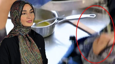 MasterChef Beyza’nın yüzüne kızgın yağ döküldü! Korkunç görüntüler yayınlandı - Magazin