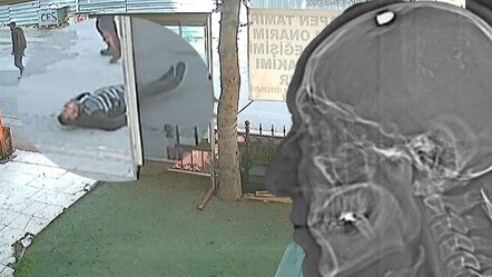 Ankara’da sosyal medya kavgası! Tekrar vurulmamak için ölü taklidi yaptı, korkunç görüntüler ortaya çıktı - gundem