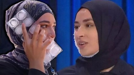 MasterChef Beyza yarışmaya devam edecek mi, son durumu ne? Yüzüne kızgın yağ dökülmüştü  - haberler