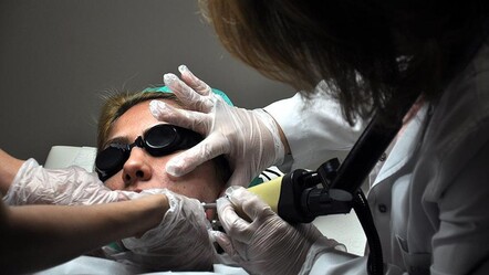 Yaz bitti, uzmanlar uyardı! Benlerinizi kontrol ettirin - saglik