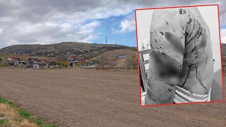 Köpek sürüsü 13 yaşındaki Alper'i parçaladı! Küçük Alper doktor gözetiminde - saglik