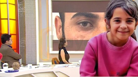 Enes Güran'ın gözünün altındaki morluklar tartışmaya neden olmuştu! Yara izinin sırrıyla ilgili dikkat çeken iddia - gundem