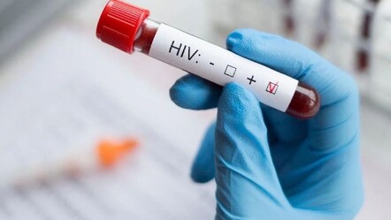 İHA-HIV virüsü hakkında bilinen yanlışlar ve tedavi yolları neler?  - gundem