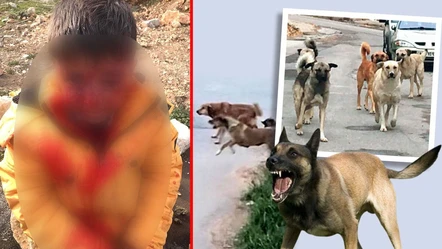 Başıboş köpek saldırısı! Küçük çocuk ağır yaralandı, acil ameliyata alındı - Gündem