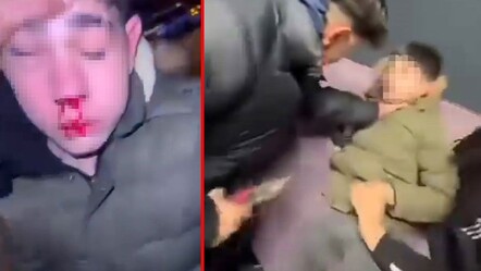 Sosyal medya yasası acilen çıkmalı! İşte işkencenin belgesi - medya