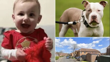 İngiltere'de başıboş köpek saldırısı! 9 aylık bebek ölümden döndü - ekonomi
