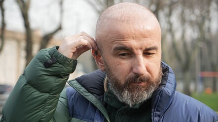 Saç ektirmek istedi, hayatı altüst oldu!