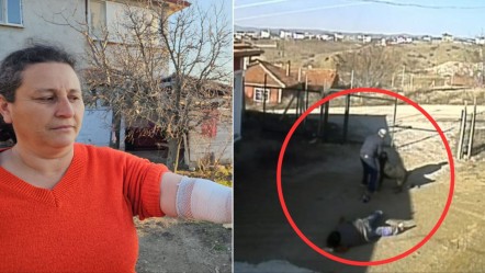 Bu kez sahipli köpek saldırdı, yaralı kadın isyan etti! "Besliyorsa sahip çıksın, benim canımdan önemli değil!" - Yaşam