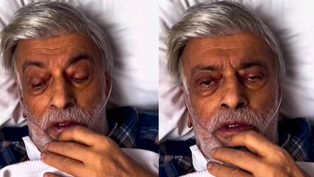 Kahtalı Mıçe'nin son halini görenler gözlerine inanamadı! Sevenlerinden dua istedi - magazin