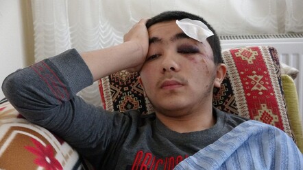 Sokak köpeklerinin kovaladığı genç düştü! Kafatası çatladı - gundem