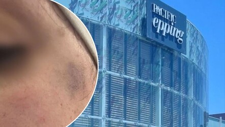 Hamile kadını kendi başörtüsüyle boğmaya çalıştılar! Avustralya Başbakanı Müslümanlardan özür diledi - dunya