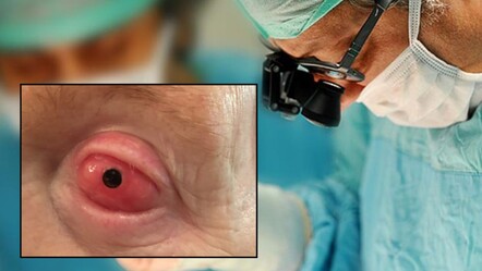 Görme engellilere umut ışığı! Dişten alınan parça göze takıldı - dunya