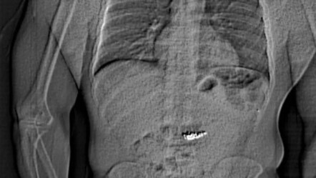 Hırsızdan akılalmaz hareket! Yakalanmadan önce çaldıklarını yuttu - gundem