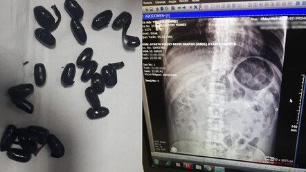 Karnında uyuşturucuyla geldi, havalimanında yakalandı: Brezilya'da yuttum, İstanbul'da satacaktım - dunya