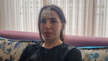 Konya'nın ardından bu kez de Esenyurt! Başıboş köpekler kadına saldırdı - gundem