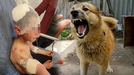 Ölümden son anda kurtuldu! Sokakta oynayan çocuğa başıboş köpek saldırdı - gundem