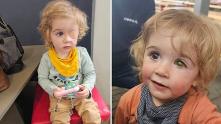 2 yaşındaki çocuk faciayı yaşadı! Bir öpücükle gözünden oldu - dunya