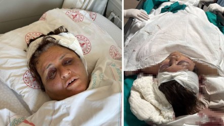 İzmir’de gelin dehşeti! Kayınvalidesini tuğlayla dövdü, sebebi ise kan dondurdu - Gündem