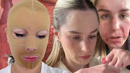 Tatil için gittiği yerde dehşeti yaşadı! Hem vücudu yandı, hem ailesini kaybetti - gundem