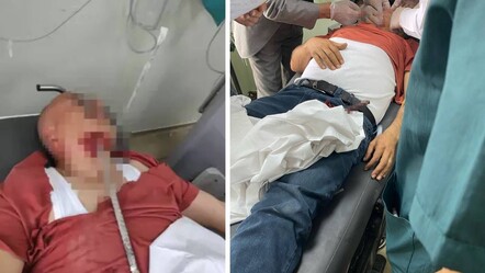 Hatay'da dehşete düşüren olay! Yüzüne demir saplanan işçi faciayı yaşadı - dunya