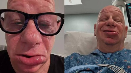 Ünlü komedyen yediği dondurma sonrası hayatının şokunu yaşadı! Görenler tanıyamadı - magazin