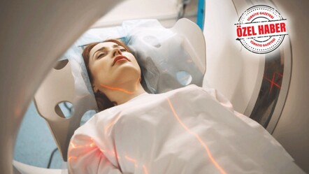 Kansere ışık hızında tedavi! Yapay zekâ el attı, tümöre direkt ve hızlı radyoterapi - gundem