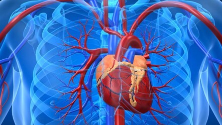 Aort damarı yırtılması (aort diseksiyonu) nedir, neden olur? Vücuttaki en büyük damar aortun önemi gündemde! - gundem