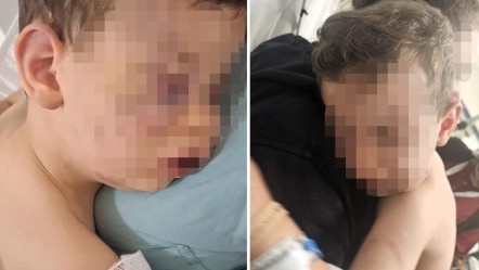Denizli'de 2 yaşındaki bebeğe kan donduran eziyet! Bakanlık hemen devreye girdi - 3. Sayfa