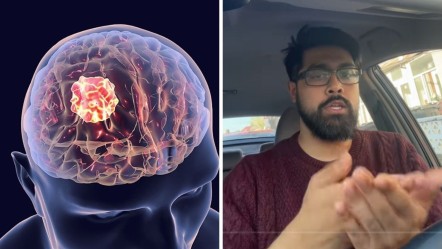 Bu hareketleri yapamayanlar dikkat! 30 saniyelik test hayatınızı değiştirebilir - Sağlık
