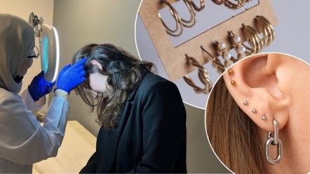 Metal küpeler, bileklikler, kolyeler gizli tetikleyici! Kaşıntıyla başlıyor, dikkat edilmezse hayat boyu devam ediyor - Yaşam