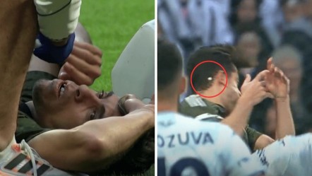 Beşiktaş üst üste sakatlıklarla sarsıldı! Yıldız oyuncunun dişi kırıldı, havada süzüldü - Spor