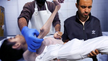 Gazze'de açlıktan ölen çocuk sayısı artıyor! 29 çocuk can verdi, 6'sı ölümün eşiğinde - Dünya