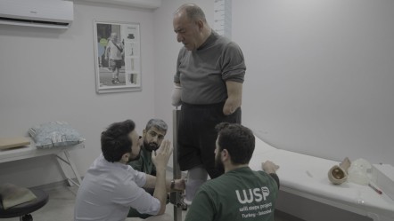 Üç uzvunu kaybetti, protezlerle hayata tutundu - Yaşam