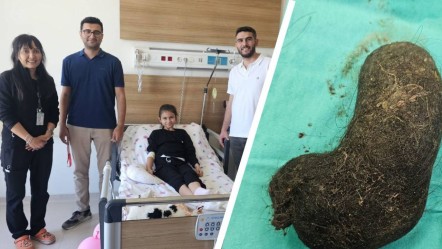 Bulantı ve ağrı şikayetiyle başvurmuştu! Midesinden çıkanlar hayrete düşürdü - Sağlık
