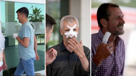 O ilimiz acemi kasaplıkta seviye atladı! 1 günde 310 kişi acile koştu - Yaşam