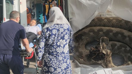 Gittiği piknik kabusu oldu: Yılan, en savunmasız anında soktu! - Yaşam