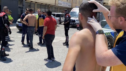 Aksaray'da 3 arkadaşın keser ve sopalı kavgası! Yaralandılar, şikayetçi olmadılar - 3. Sayfa